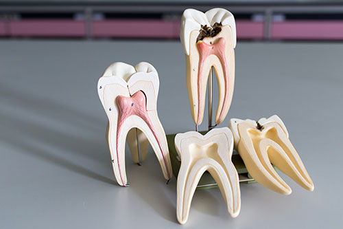 Tooth model for education in laboratory.