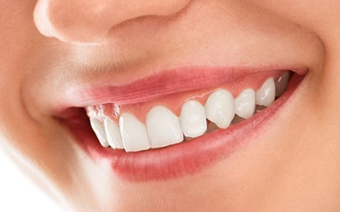 cos-smil-ser-img